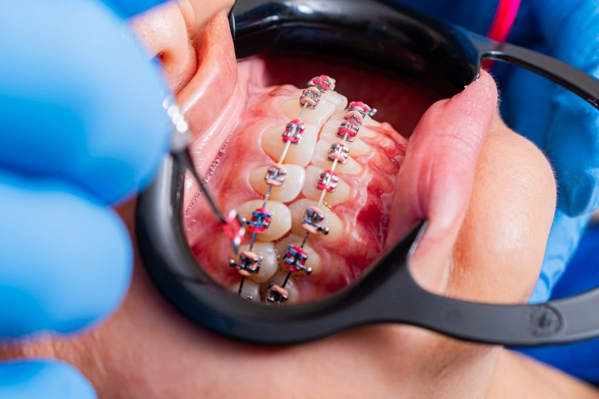 看牙医其实没那么复杂 | 跟着 United Dental Surgery 拆解新加坡牙科的门门道道