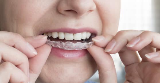 新加坡成人牙科